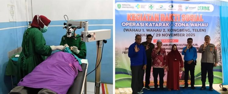Pemkab Kutim dan PERDAMI Gelar Operasi Katarak Gratis, 72 Warga Kembali Dapatkan Penglihatan Optimal